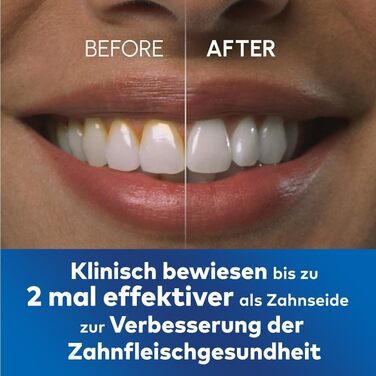 Waterpik Професійний іригатор, Тест-переможець 2025, Технологія Precision Pulse, Сертифікат TÜV, видалення нальоту до 99,9%, 6 насадок, 10 режимів, таймер, чорний